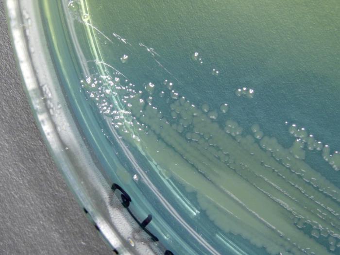 Multiphase Terminal Environmental Disinfection Targets Acinetobacter baumannii in ICUs